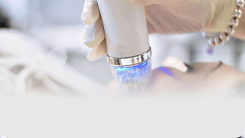 RF-Vi-Điểm-(RF-Microneedling)--Tại-sao-công-nghệ-này-được-dự-đoán-“chiếm-sóng”-ngành-làm-đẹp-2026-